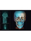 OP 3D Vision – панорамный томограф