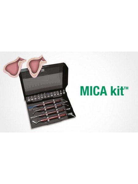 MICA kit – набор для закрытого синус-лифтинга