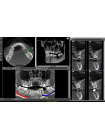 Fona XPan 3D Аппарат рентгеновский панорамный томографический цифровой 3D съемки с принадлежностями